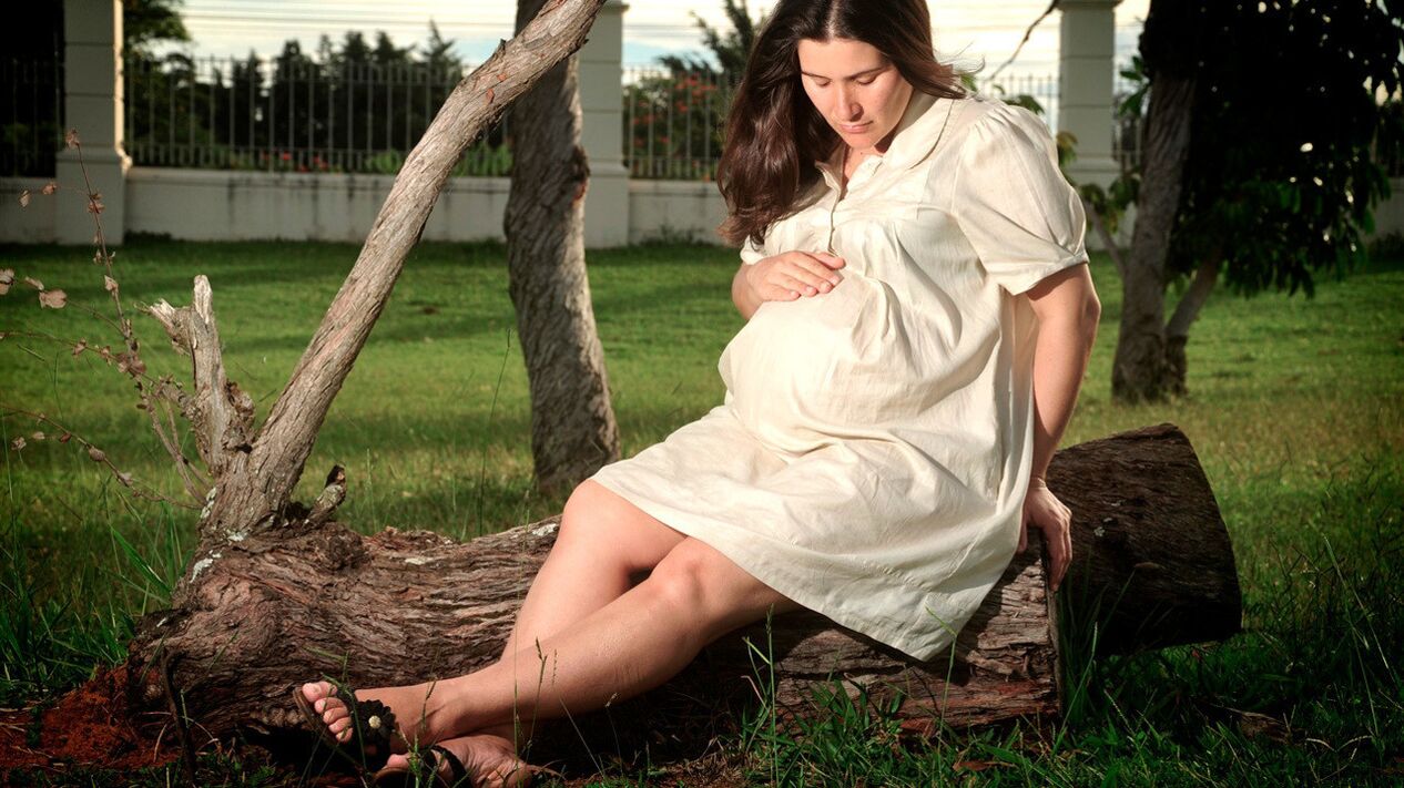 Pregnancy is a factor in the development of varicose veins in the legs. 