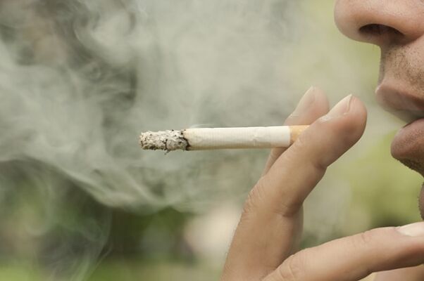 Smoking is one of the reasons for the development of reticular varicose veins. 